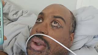 When you get into an accident and your boss calls in the middle of surgery