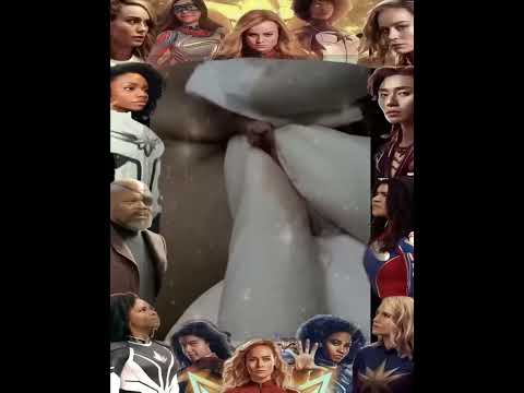 Big Cystic Acne Blackheads Extraction Blackheads & Milia, Whiteheads Removal Pimple Popping
