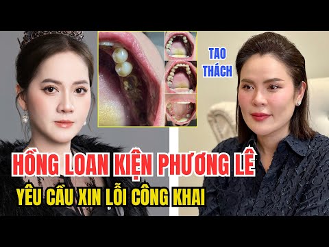 NÓNG: Hồng Loan kiện Nha khoa của Phương Lê vì vụ làm răng sứ - TIN GIẢI TRÍ