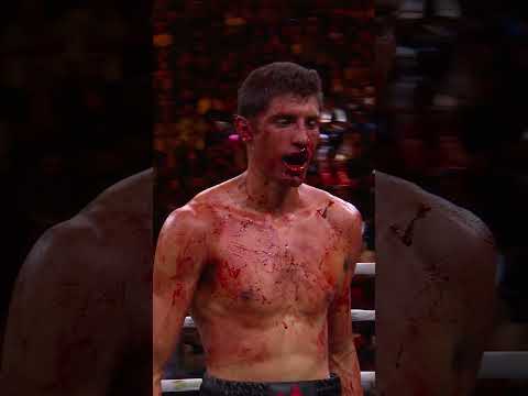 Sebastian Fundora Endures a Bloody Battle to Become a Unified 154-lb Champ