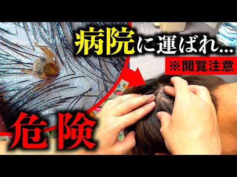 【閲覧注意】危険な虫に頭を噛まれて病院に行きました
