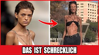 21 Promis & Der Preis Der Perfektion: Hollywoods Dunkle Wahrheit | Vorher/Nachher 2025