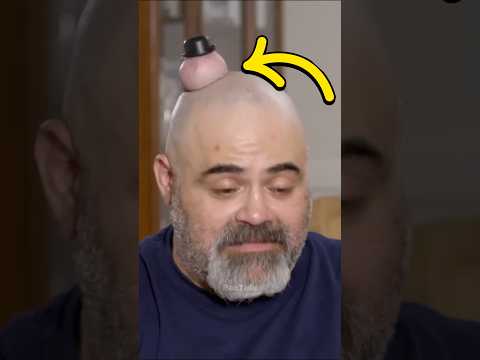 This man had a lump on his head! 😨 Part - 2 #facts #shorts
