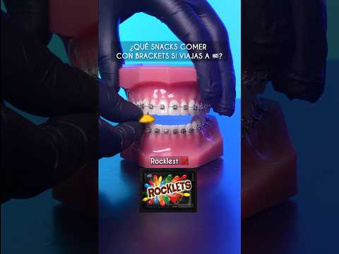 ¿Qué comer con Brackets en 🇺🇾? - Odontología Láser #Shorts