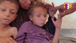 10-year-old Nafez is starving to death in Gaza