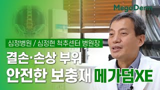 심정병원 심정현 척추센터 원장 "결손•손상 부위 안전한 보충재 메가덤XE"
