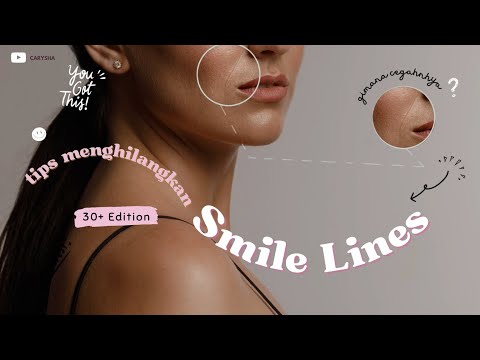 Risih sama SMILE LINES ? Begini cara cegahnya | 30+ EDITION