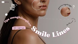 Risih sama SMILE LINES ? Begini cara cegahnya | 30+ EDITION