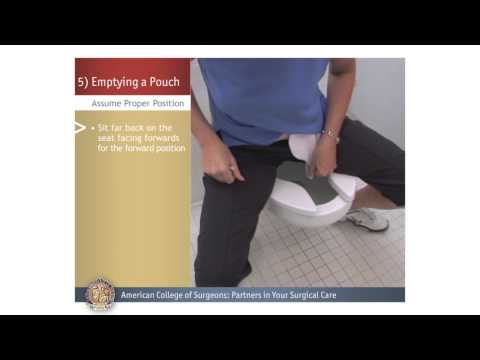 Colostomy/Ileostomy: Emptying a Pouch