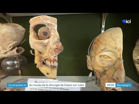 Ça Se Passe Ici - Le seul musée en France consacré à la chirurgie