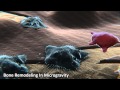 Bone Health and Space Research