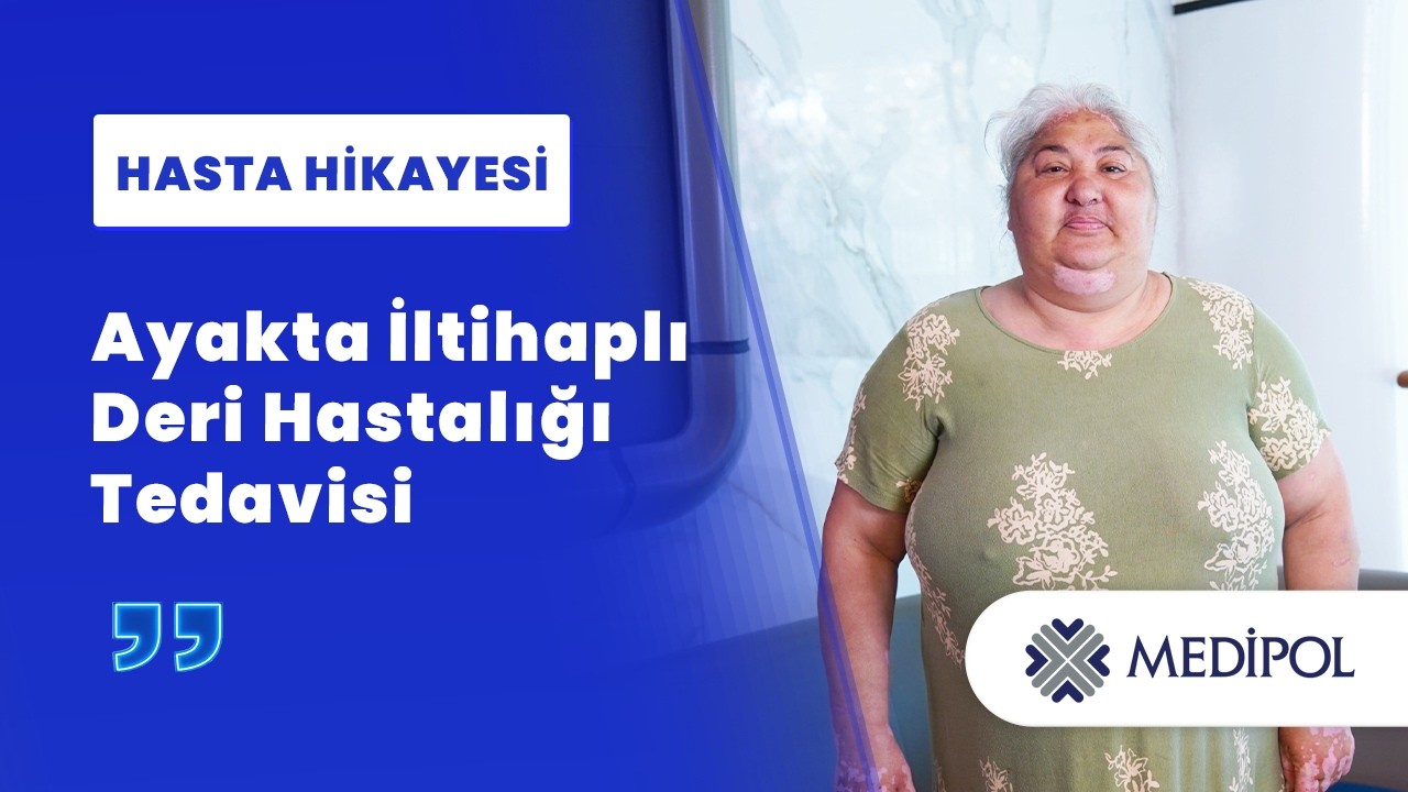 Küçük Bir Yaradan Büyük Bir Soruna: Pyoderma Gangrenosum Tedavisi | Serpil Hanım'ın Hikayesi