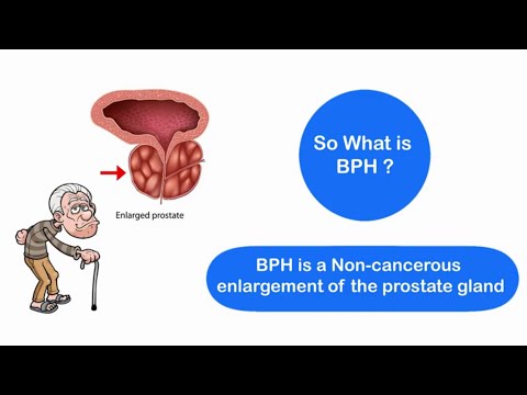 Benign Prostatic Hyperplasia (Enlarged Prostate), its Causes and Symptoms