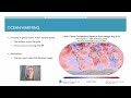 Coral Bleaching and Ocean Warming