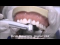 Dental Preparation Techniques and Considerations