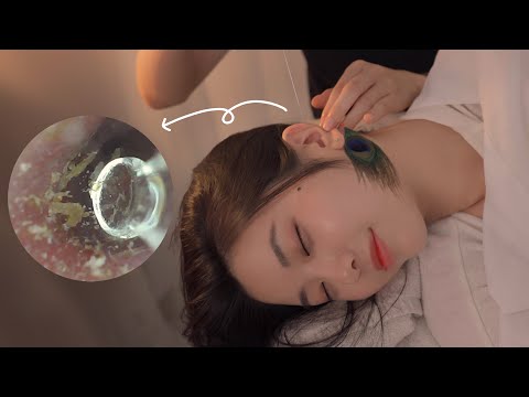 ASMR 보면서 받는 귀청소👂 | 내시경 구름칼 공작털 솜털 | Visual Ear Cleaning asmr