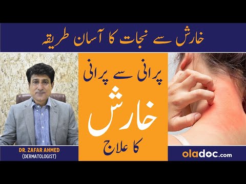 Kharish Khatam Karne Ka Tarika - Scabies Ka Ilaj In Urdu - Itching Treatment - Kharish Ka Fori Ilaj