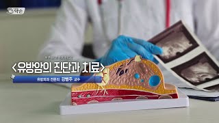 [TV메디컬약손]20241119(756회) 보존하고 완치한다 <유방암의 진단과 치료>_칠곡경북대학교병원 유방외과 강병주 교수 다시보기