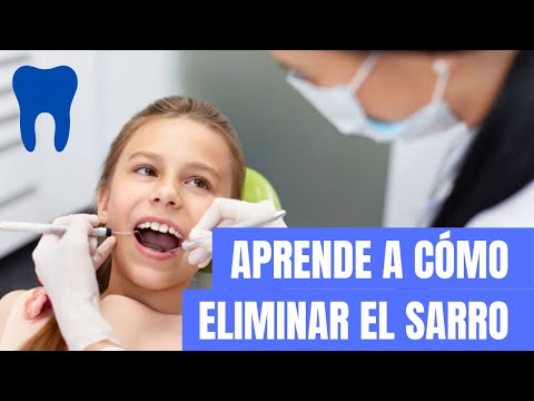 ¡Secretos Dentales Revelados! Cómo Eliminar el Sarro con Consejos de un Dentista Amigo 🦷💡