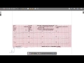 EKG Calibration and Interpretation Concepts