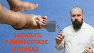 Отёки, застой лимфы, отёкшие ноги оставьте всё это в прошлом!