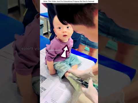 💪 Brave Baby’s Plaster Removal | Fearless Little Champ #shortvideo