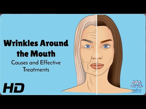 Mouth Wrinkles? Causes & Fixes You Need to Know! 👄✨