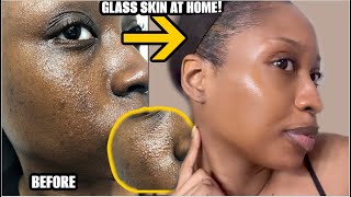 HOW TO CLEAR ACNE TEXTURED SKIN FOR GOOD OVERNIGHT | GLASS SKIN NATURAL MASK SKINCARE ROUTINE 2025