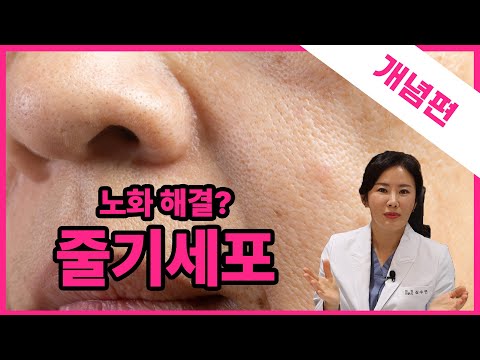 😗줄기세포 시술이 뭐라고??| 시술위키 줄기세포 개념편