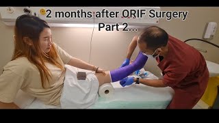 2 months after ORIF Surgery | Part ll