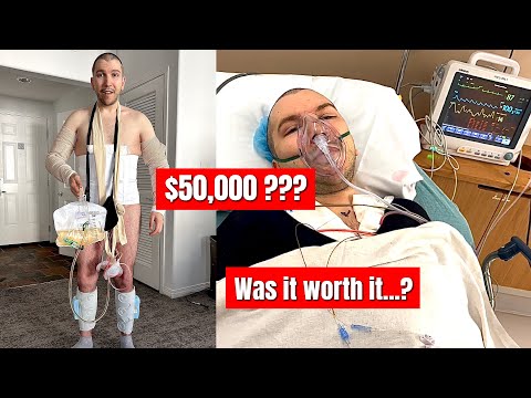 I Paid HOW MUCH for My Plastic Surgery?? (Tummy Tuck, Lipo, Body Lift, Arm & Thigh Lift)