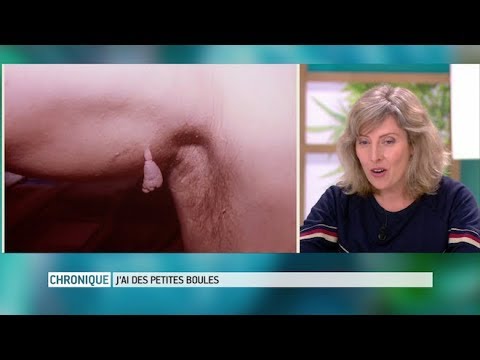 Acrochordons : comment s'en débarrasser ? - Le Magazine de la santé