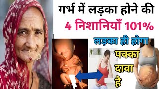 नींद कम/ज्यादा होने से क्या पता लगता है |Good/Bad Sleeping Position in Pregnancy (Part-75)