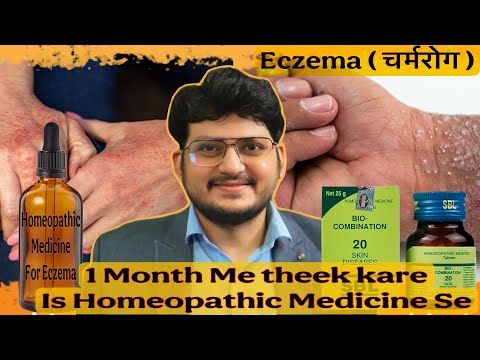 My Experience | Homeopathic Medicine for Eczema | 100% Effective |