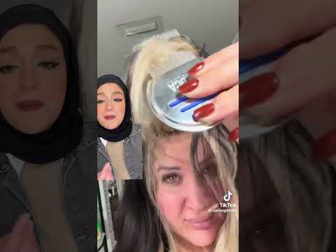 خلي بالك من نوع قشرة الشعر ده ❌