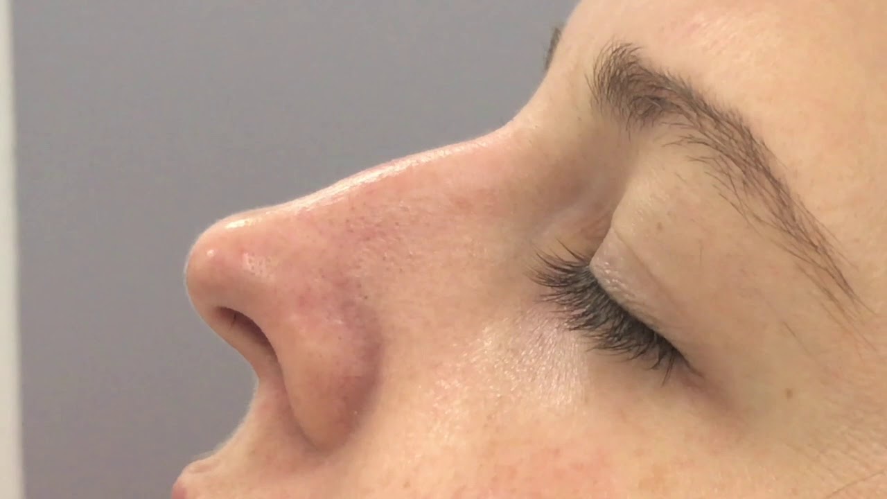Woman receiving skincare treatment in clinical setting.
