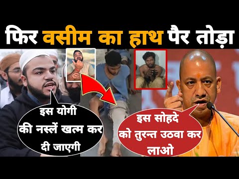Mohammad Washim दे रहा था Yogi Adityanath को गाली | फिर Up police ने हाथ पैर तोड़ा | Mr Munnabhai