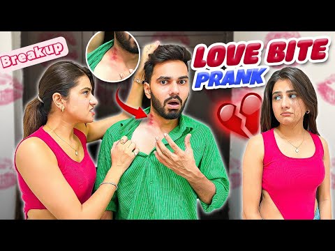 Hickey Prank Gone Wrong 😱| @Ayushyadav