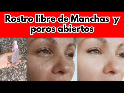 Elimina Grasa del Rostro, Manchas y Poros Abiertos Exfoliante de Arroz