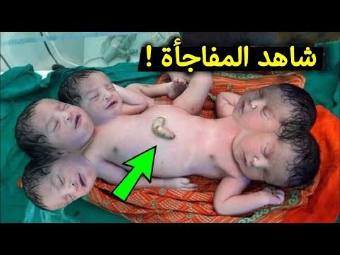 امرأة أمريكية ثانية تلد طفلا يهز العالم ويشهد أن القرآن حق | سبحان الله ..!!