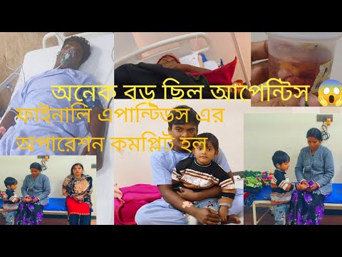 ফাইনালি ওপেন সার্জারি কমপ্লিট হল#বেঙ্গলি ব্লক ভিডিও#কেয়ার হোলিসিটি প্রাইভট হসপিটাল