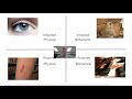 Inherited vs. Acquired Traits in Genetics