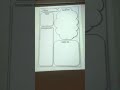 Understanding Unbalanced Forces in Motion