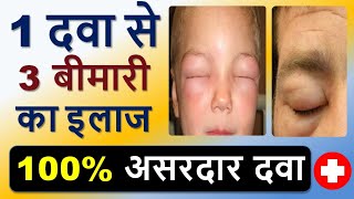 1 दवा से 3 बीमारी का इलाज | 100% असरदार दवा