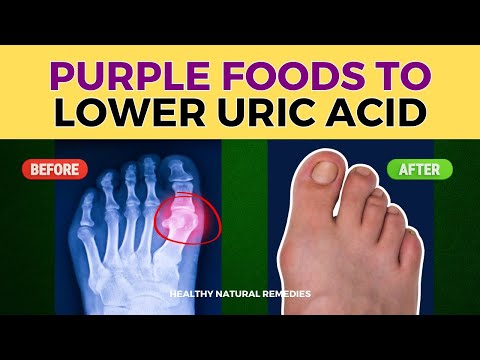 7 Incredible Purple Foods to Lower Uric Acid and Improve Your Health