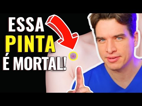 ALERTA DE CÂNCER! Se a sua PINTA se parece com ISTO, pode ser MORTAL