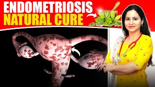 All You Need To Know About Endometriosis | Home Remedy for Endometriosis | Endometriosis Treatment