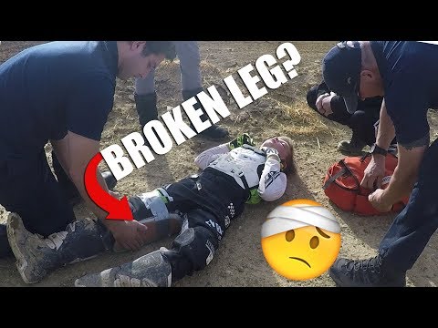I BROKE MY LEG? (GLENN HELEN MX PART 1)