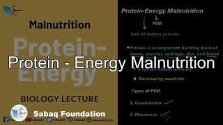 Protein - Energy Malnutrition
