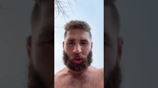 Jiri Prochazka shows his ugly foot